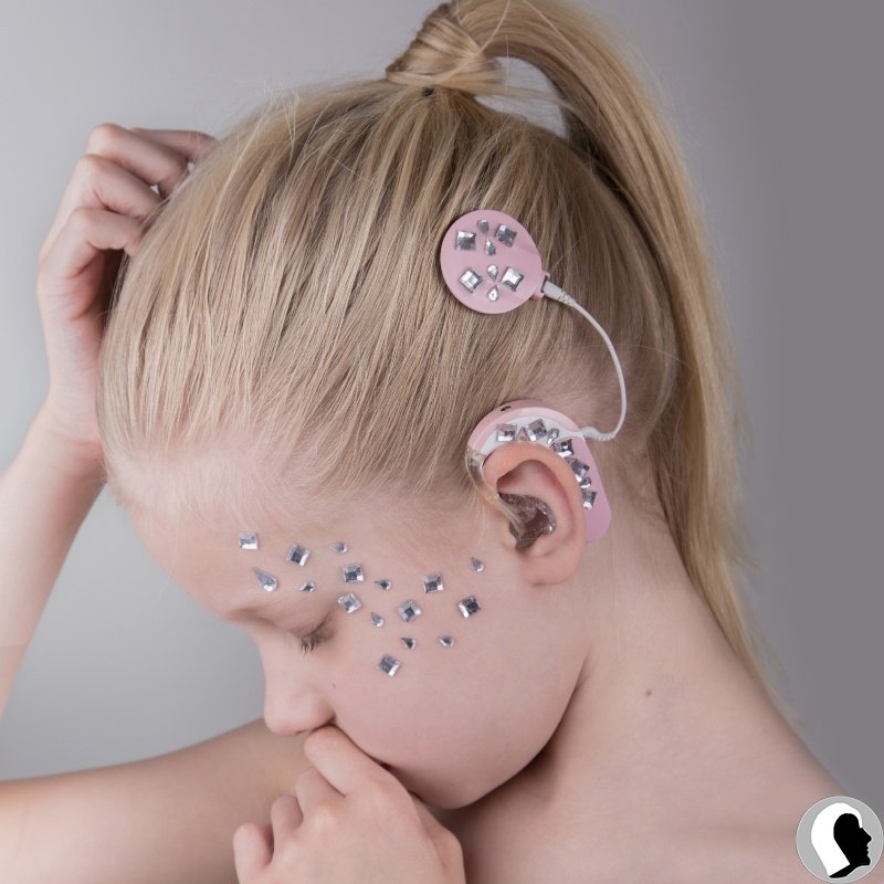 CI Kopf 2018 weiblich Kind